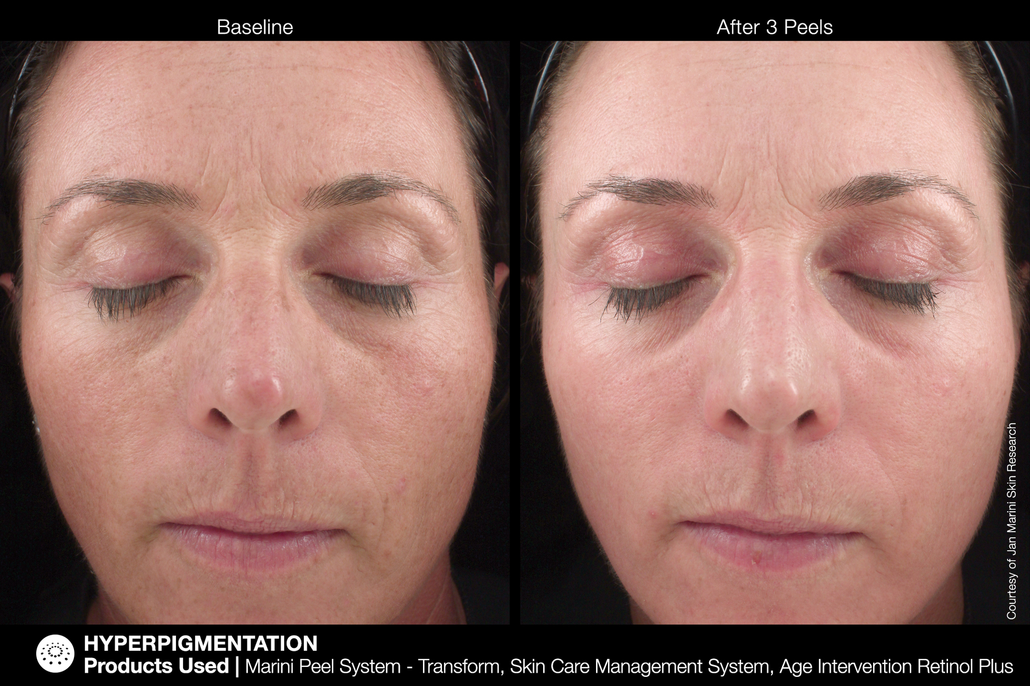 JAN MARINI AGE INTERVENTION RETINOL+ 0,5% Крем-акселератор с ретинолом 0,5% для борьбы с видимыми возрастными изменениями