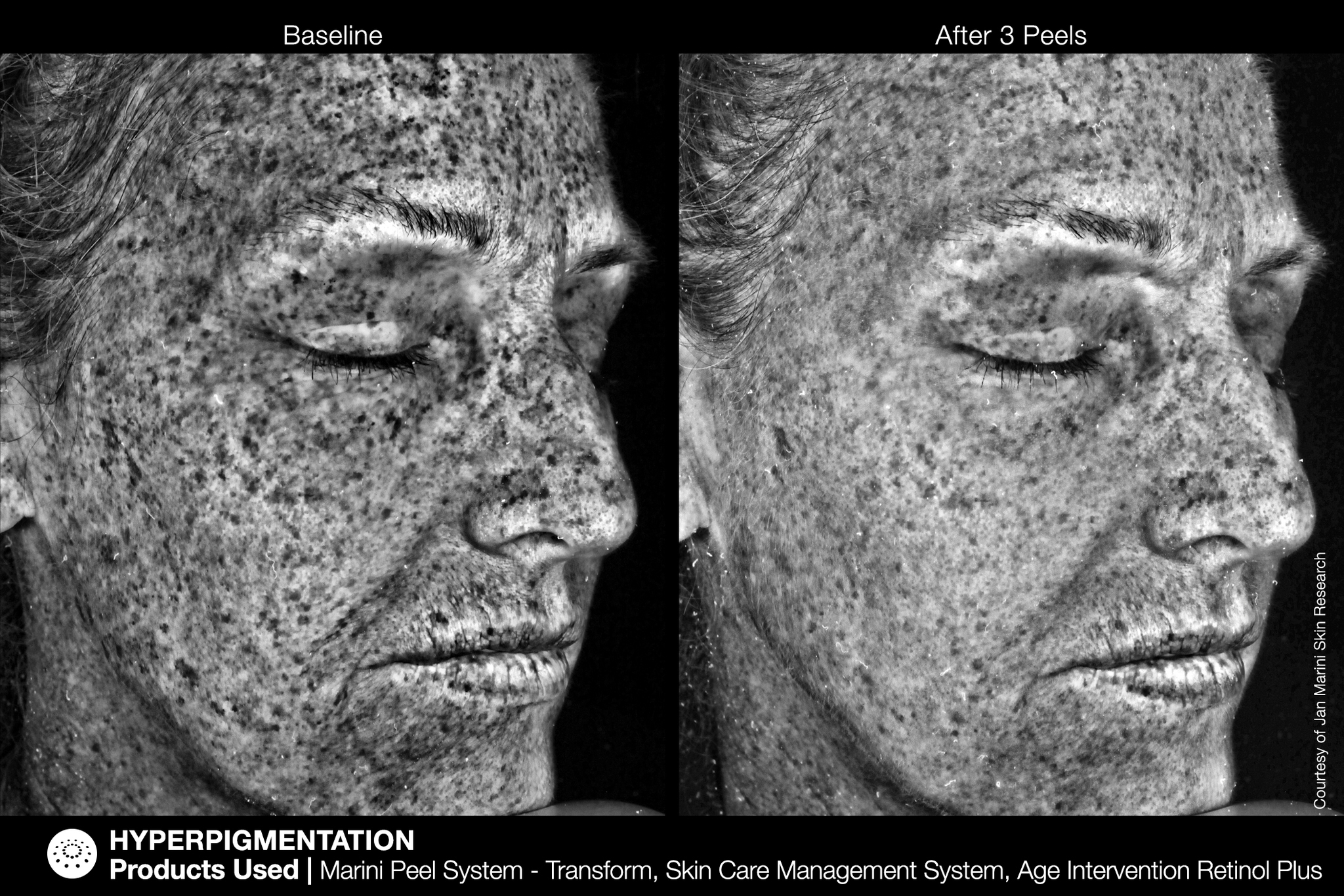 JAN MARINI AGE INTERVENTION RETINOL+ 0,5% Крем-акселератор с ретинолом 0,5% для борьбы с видимыми возрастными изменениями