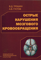 Острые нарушения мозгового кровообращения