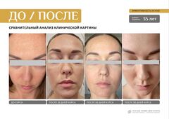 EVIPRO ANTI-AGE HYDRO-LIPID SYSTEM Омолаживающий комплекс (сыворотка 30мл, крем 30мл)