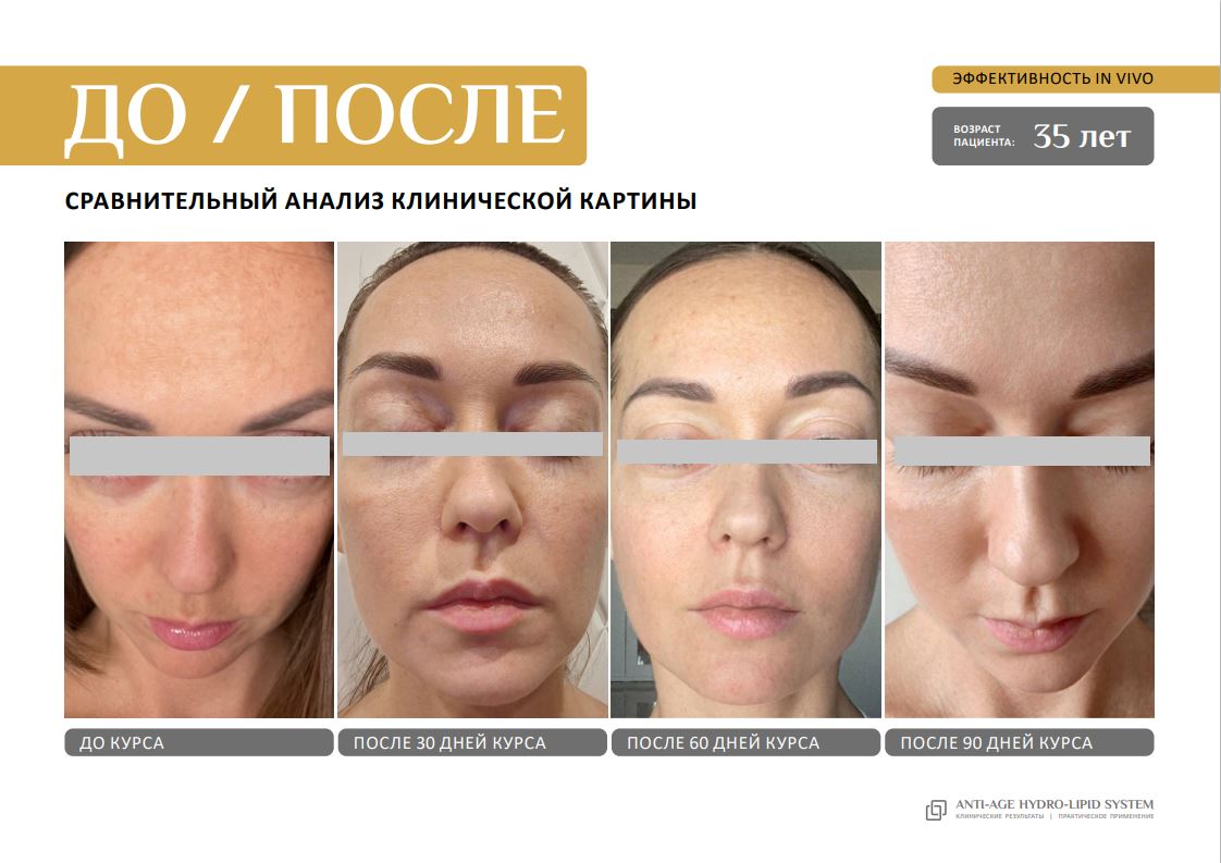 EVIPRO ANTI-AGE HYDRO-LIPID SYSTEM Омолаживающий комплекс (сыворотка 30мл, крем 30мл)