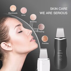 Аппарат для ультразвуковой чистки лица Sonic Skin Scrubber (черный)
