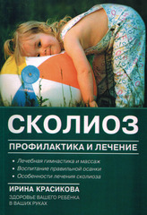 Сколиоз. Профилактика и лечение
