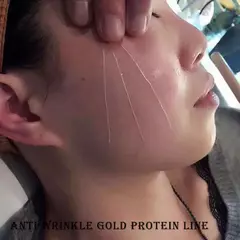 ЖИДКИЕ ЗОЛОТЫЕ ПРОТЕИНОВЫЕ НИТИ ДЛЯ ЛИЦА BingJu protein line hydrolyzed collagen