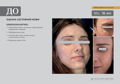 EVIPRO ANTI-AGE LIQUID GOLD Ревитализирующий спрей (50мл)