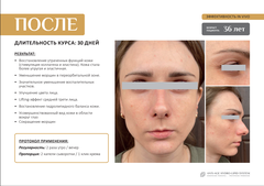 EVIPRO ANTI-AGE LIQUID GOLD Ревитализирующий спрей (50мл)