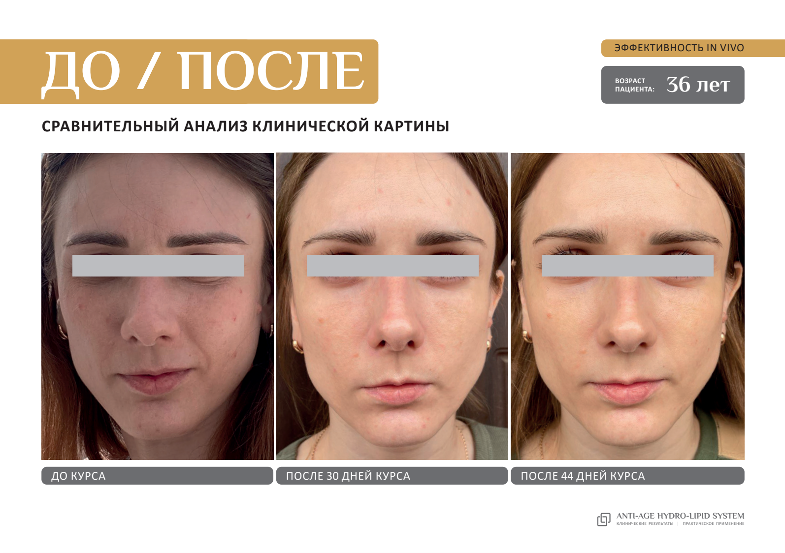 EVIPRO ANTI-AGE LIQUID GOLD Ревитализирующий спрей (50мл)