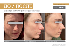 EVIPRO ANTI-AGE LIQUID GOLD Ревитализирующий спрей (50мл)