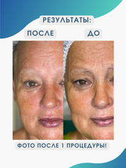 Masaru Botocurex Lifting Mask Set Маска мышечная с эффектом ботокса 250 гр