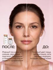 Маска мышечная с эффектом ботокса / 5 процедур набор