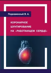 Коронарное шунтирование на "работающем сердце"