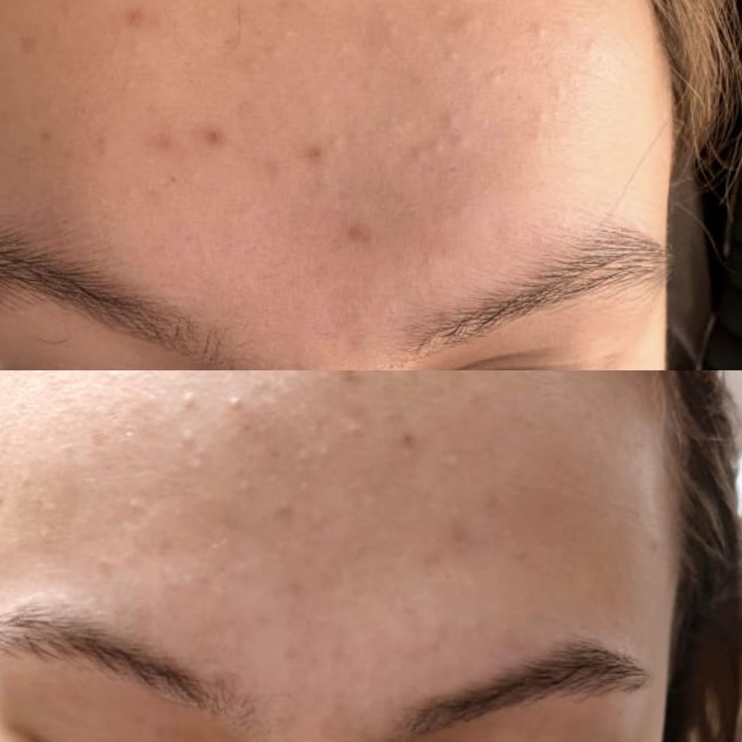 SBC Cream Night Retinol | Ночной крем-актив с ретиноидами для бережного обновления и омоложения