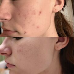 SBC Cream Night Retinol | Ночной крем-актив с ретиноидами для бережного обновления и омоложения