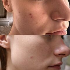 SBC Cream Night Retinol | Ночной крем-актив с ретиноидами для бережного обновления и омоложения