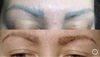 White color Liquid laser 30 мл купить за 11000&nbsp;руб