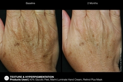 JAN MARINI RENU CORRECTIVE HAND COMPLEX Антивозрастной корректирующий крем для рук