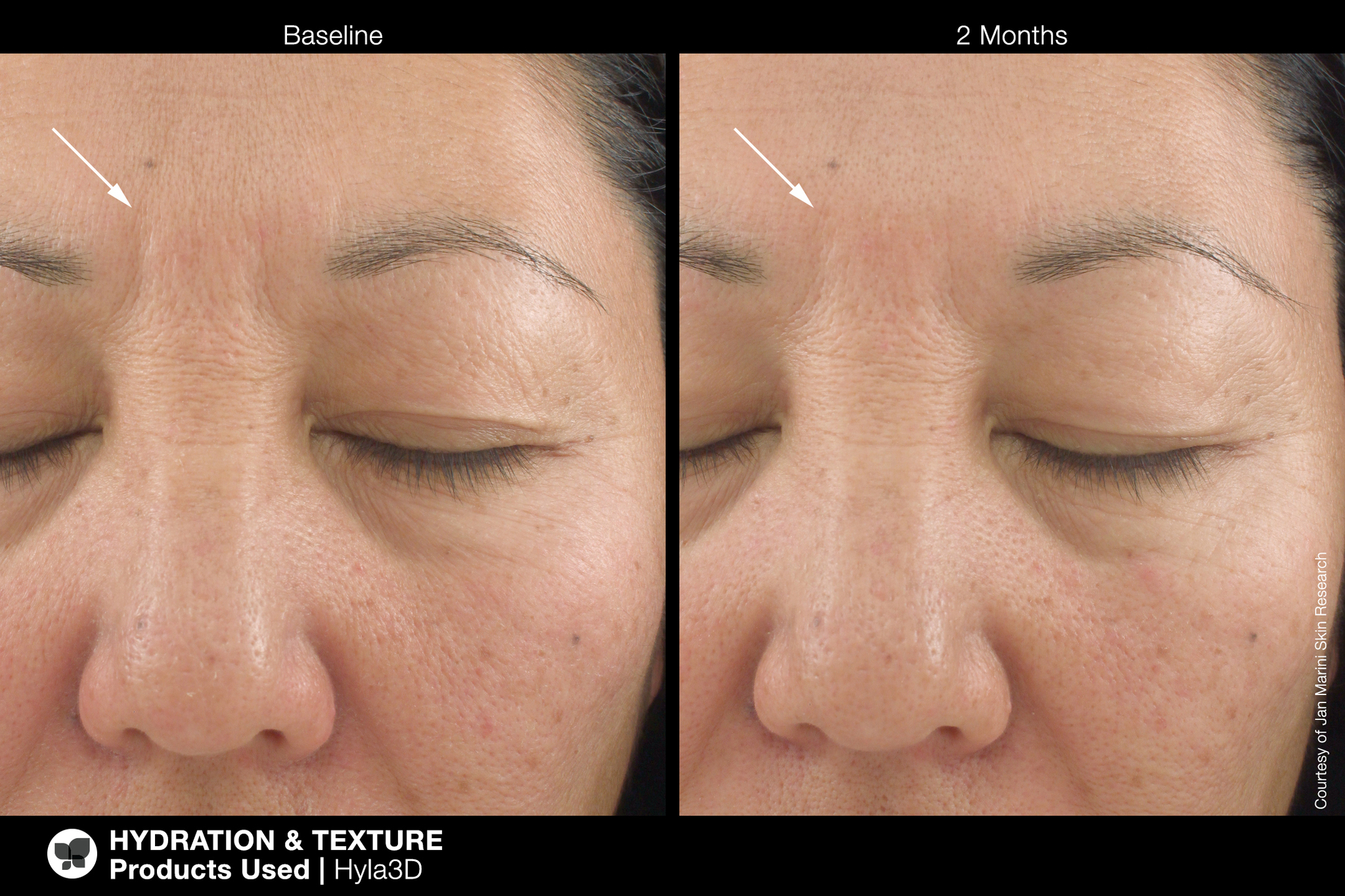 JAN MARINI HYLA3D FACE SERUM Сыворотка-акселератор с 3D гиалуроновым комплексом