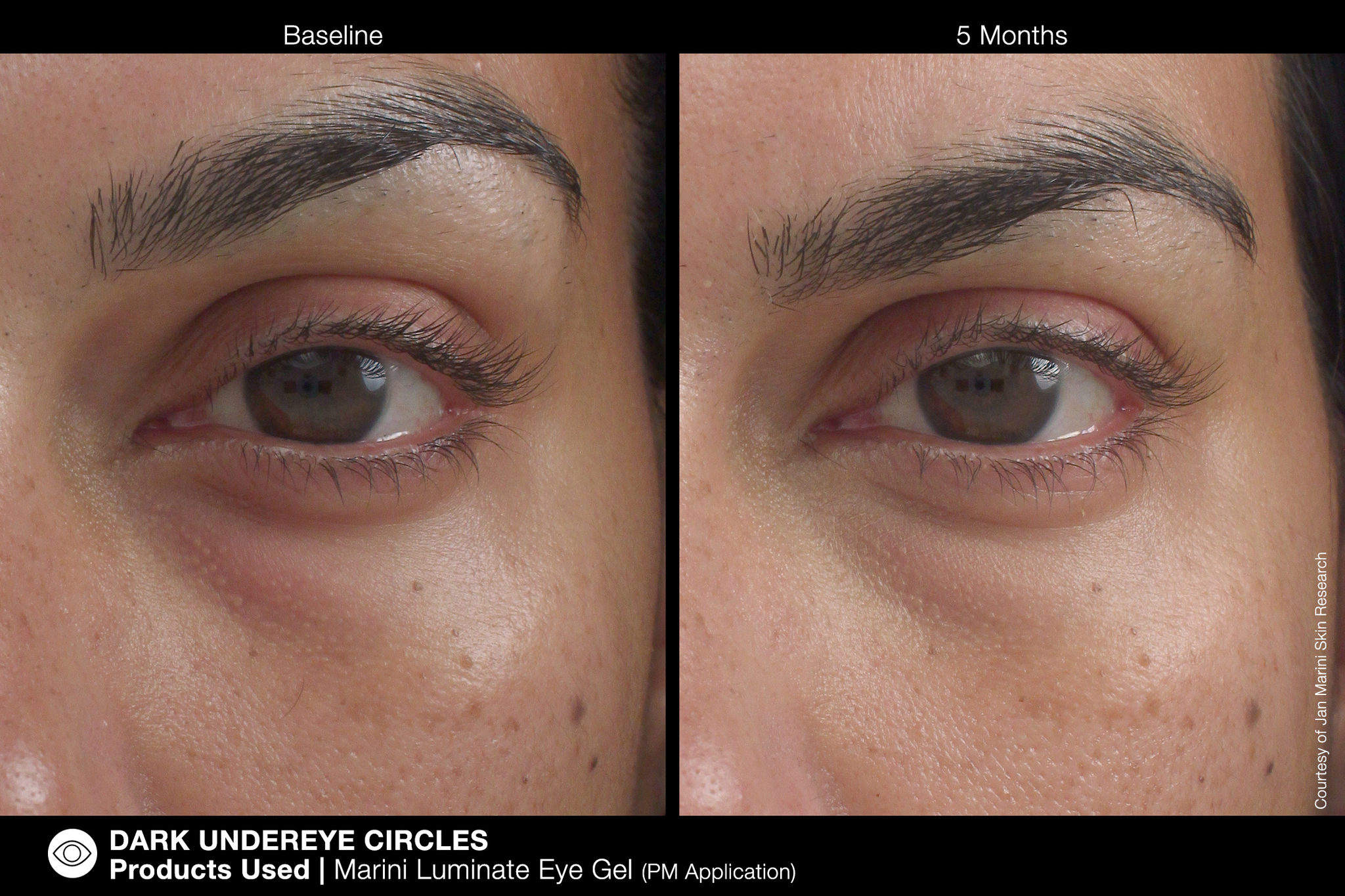 JAN MARINI LUMINATE EYE GEL Концентрированная сыворотка для кожи вокруг глаз с эффектом сияния против темных кругов и морщин