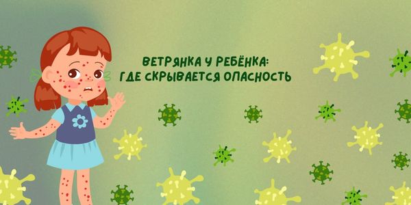 Ветрянка у ребёнка: где скрывается опасность Ветрянка у ребёнка: где скрывается опасность