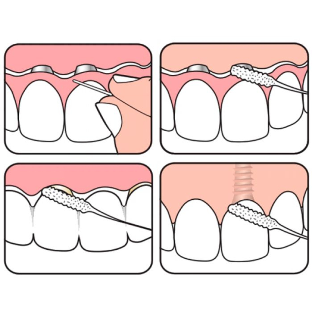 Межзубная нить для мостов и имплантов ТePe Bridge and Implant Floss, 1 уп. (в упаковке 30 нитей), США