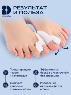 Бурсопротектор для большого пальца