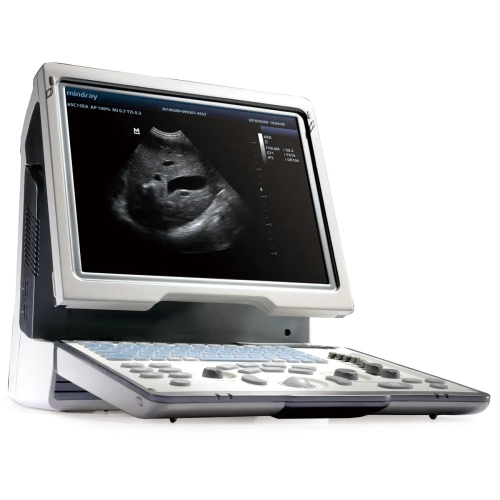 Аппарат УЗИ (сканер) Mindray DP-50