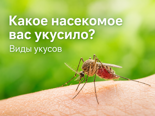 Какое насекомое вас укусило? Виды укусов Какое насекомое вас укусило? Виды укусов