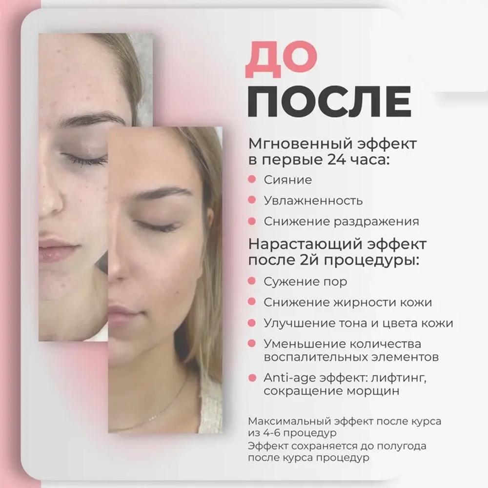 Vit + Amino AGT Bio | Здоровая и чистая кожа