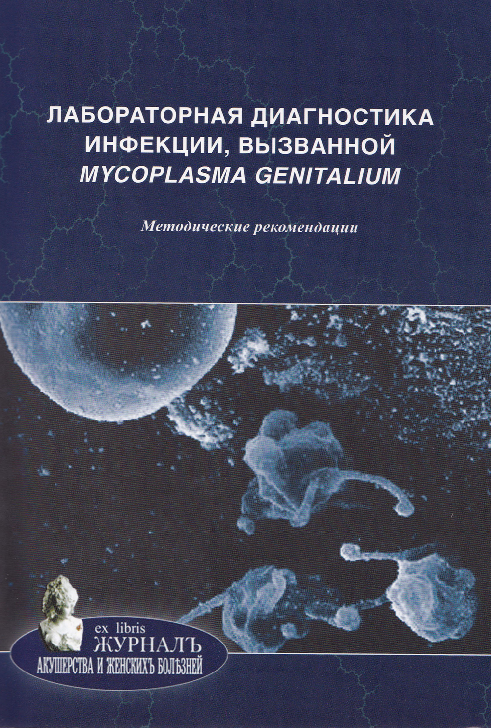 Лабораторная диагностика инфекции, вызванной Mycoplasma genitalium