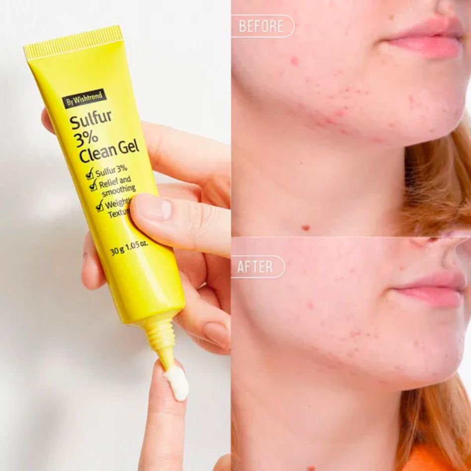 Локальный гель против акне By Wishtrend Sulfur 3% Clean Gel 30мл