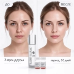 Luminescence Kit