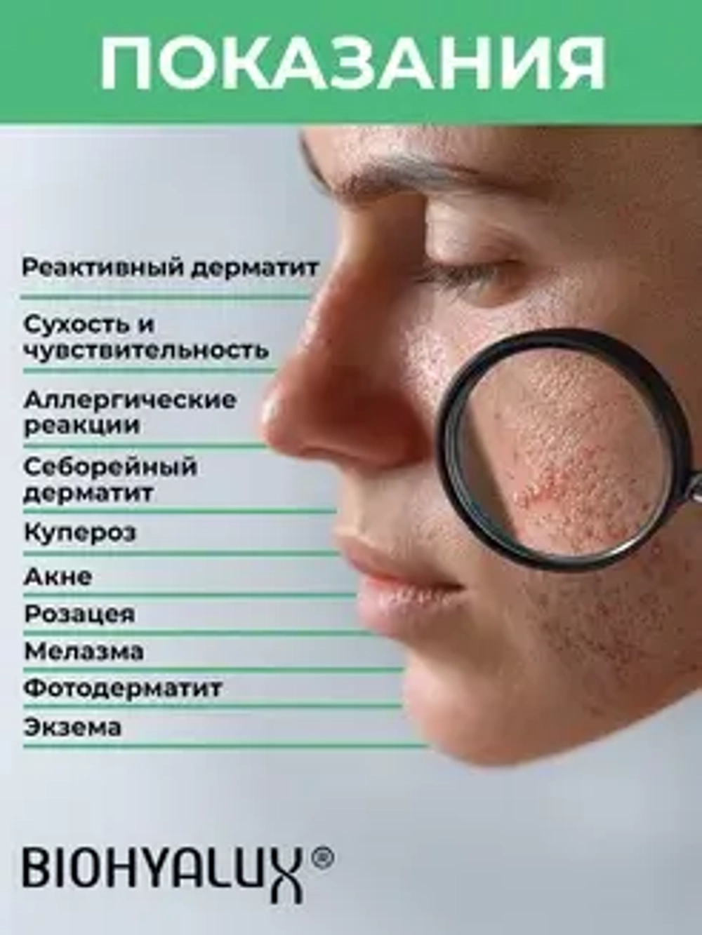 Крем восстанавливающий и увлажняющий с гиалуроновой кислотой | BIOHYALUX HA Barrier Conditioning Cream, 30 гр