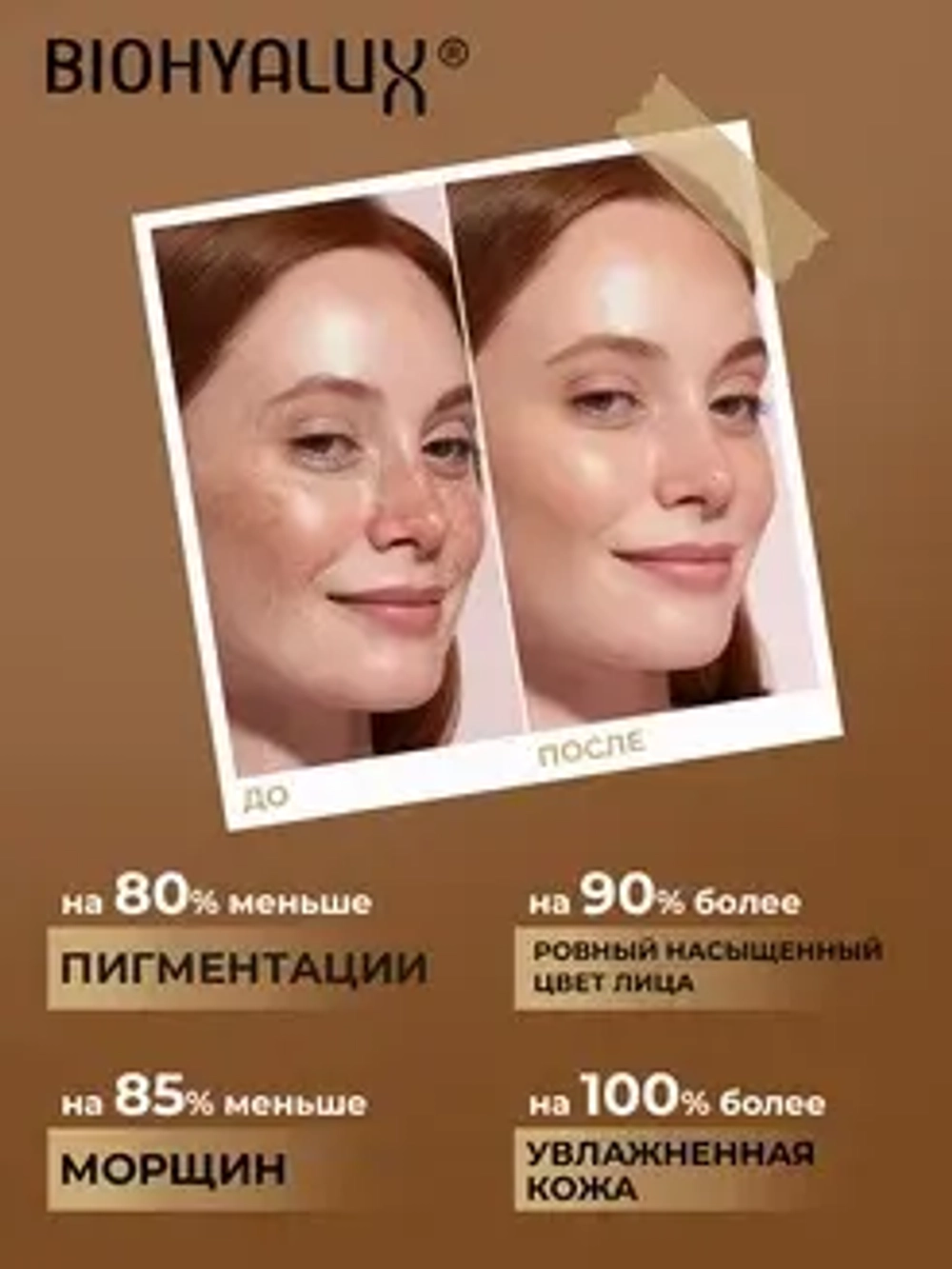Увлажняющая маска с гиалуроновой кислотой для восстановления и защиты кожи | BIOHYALUX HA Moisturizing Essence Mask, 5 масок