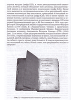 Гастродуоденальные язвы и хронический гастрит