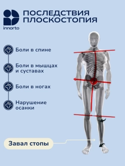 Супинаторы ортопедические при плоскостопии, 1 пара