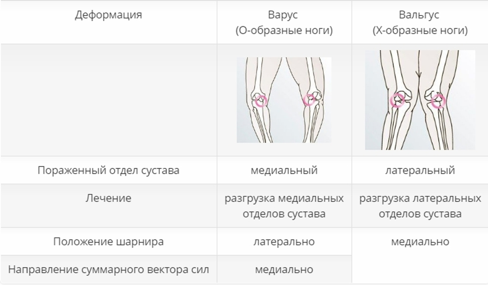 Жесткий коленный ортез для лечения остеоартроза укороченный M.4s OA short