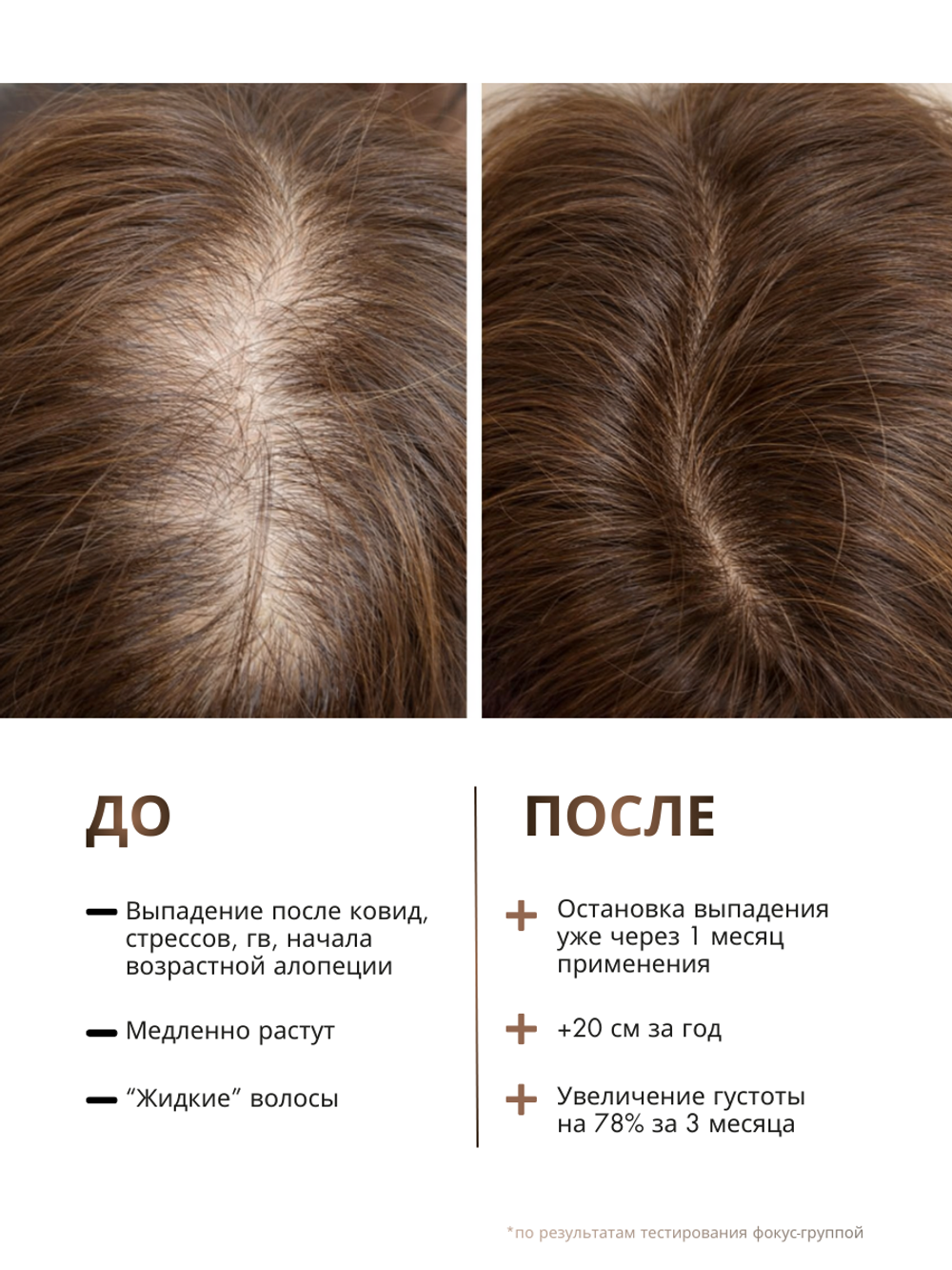 Сыворотка GROW IT от выпадения и для роста волос