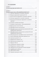 Лучевая диагностика заболеваний и повреждений височной кости