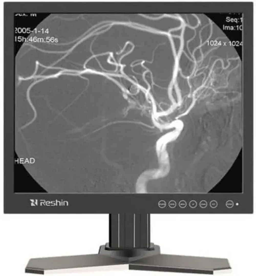 Монитор  RESHIN MD17G