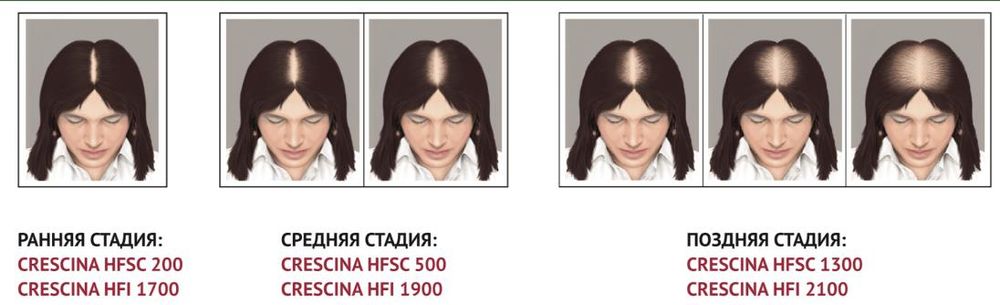 Crescina Transdermic HFSC 100% RE-GROWTH + ANTI-HAIR LOSS КОМПЛЕКС лосьон для возобновления роста волос + лосьон против выпадения волос для женщин. Дозировка 1300 / 20+20 ампул