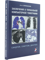 Заключение в торакальной компьютерной томографии. Симптом, синдром, диагноз