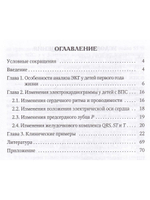 Анализ электрокардиограммы у детей раннего возраста с врожденными пороками сердца