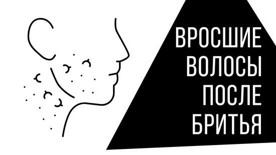 Вросшие волосы у мужчин: почему возникают и как с ними бороться