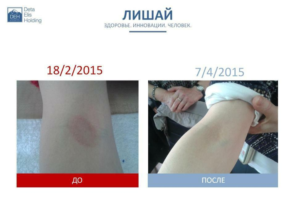 Устройство "DeVita AP + " модель "Mini"