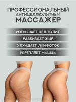 Антицеллюлитный массажер для тела