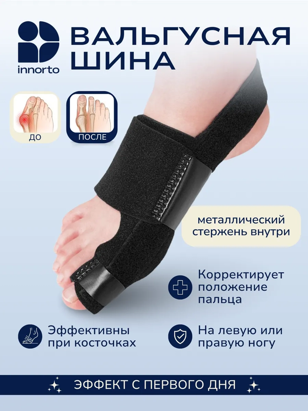 Ортез для вальгусного пальца ноги