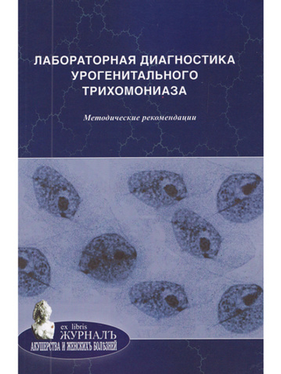 Лабораторная диагностика урогенитального трихомониаза: методические рекомендации