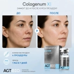 Cologenum X AGT Bio