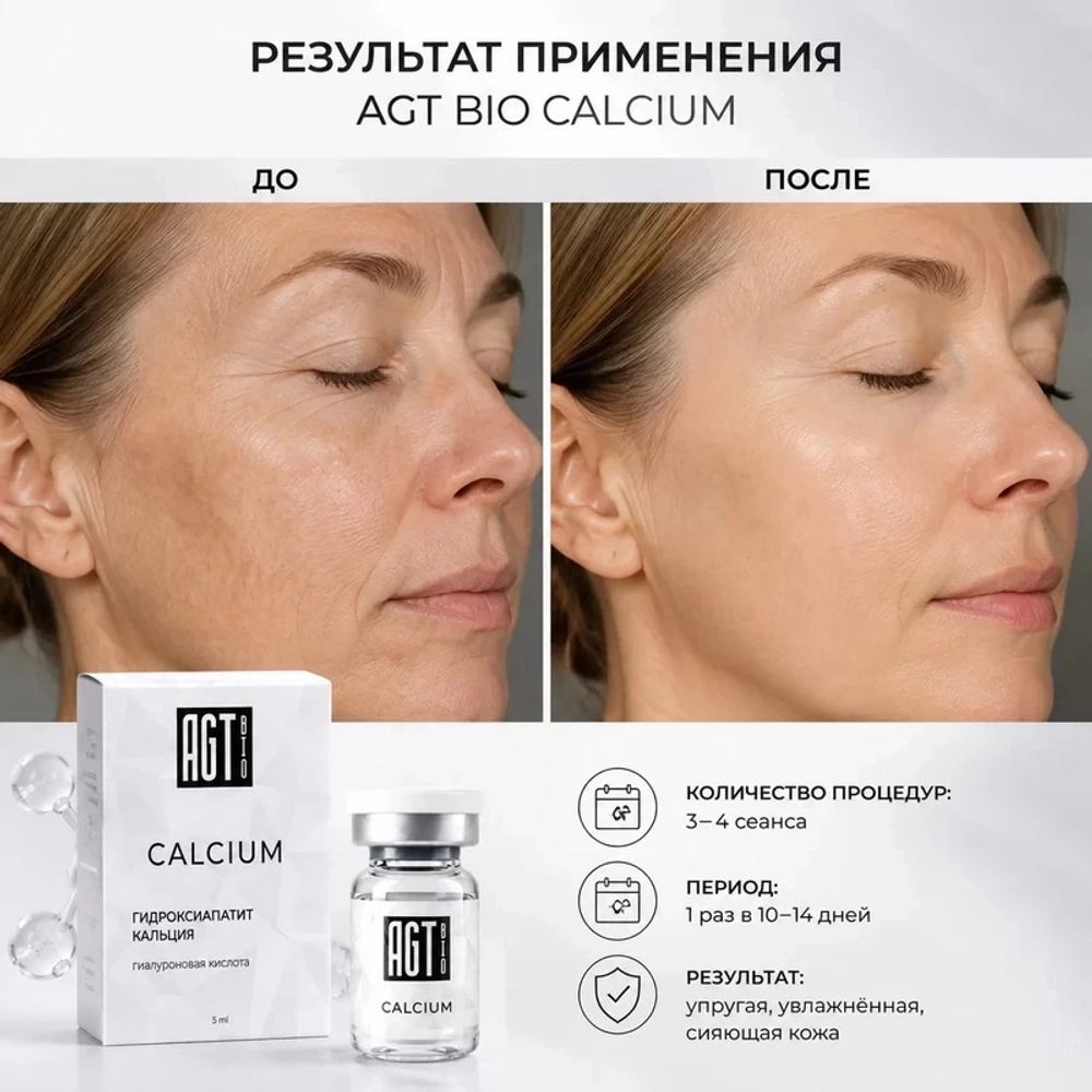 Calcium AGT Bio