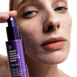 Allies of Skin Azelaic & Kojic Advanced Clarifying Serum 30ml